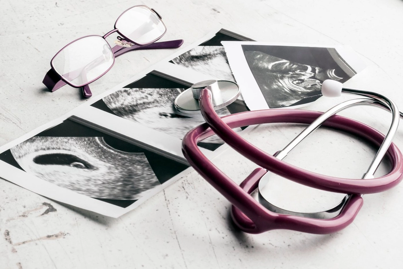 usr propune o lege pentru fertilizarea in vitro subliniind ca infertilitatea este o problema de sanatate publica